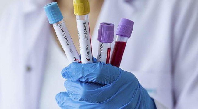 Türkiye'nin koronavirüsle mücadelesinde son 24 saatte yaşananlar
